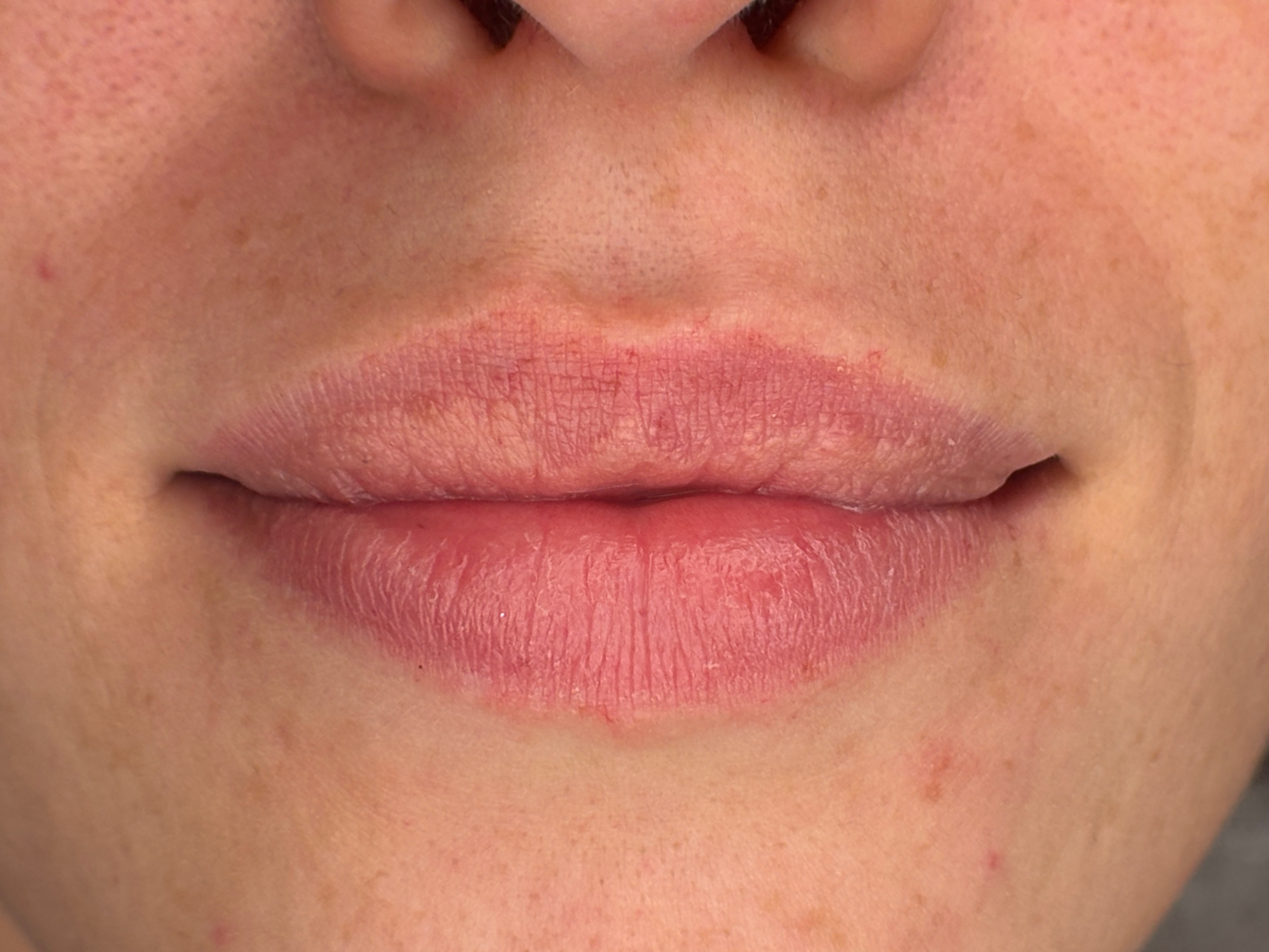 Lippen vor der Lip Blush Behandlung
