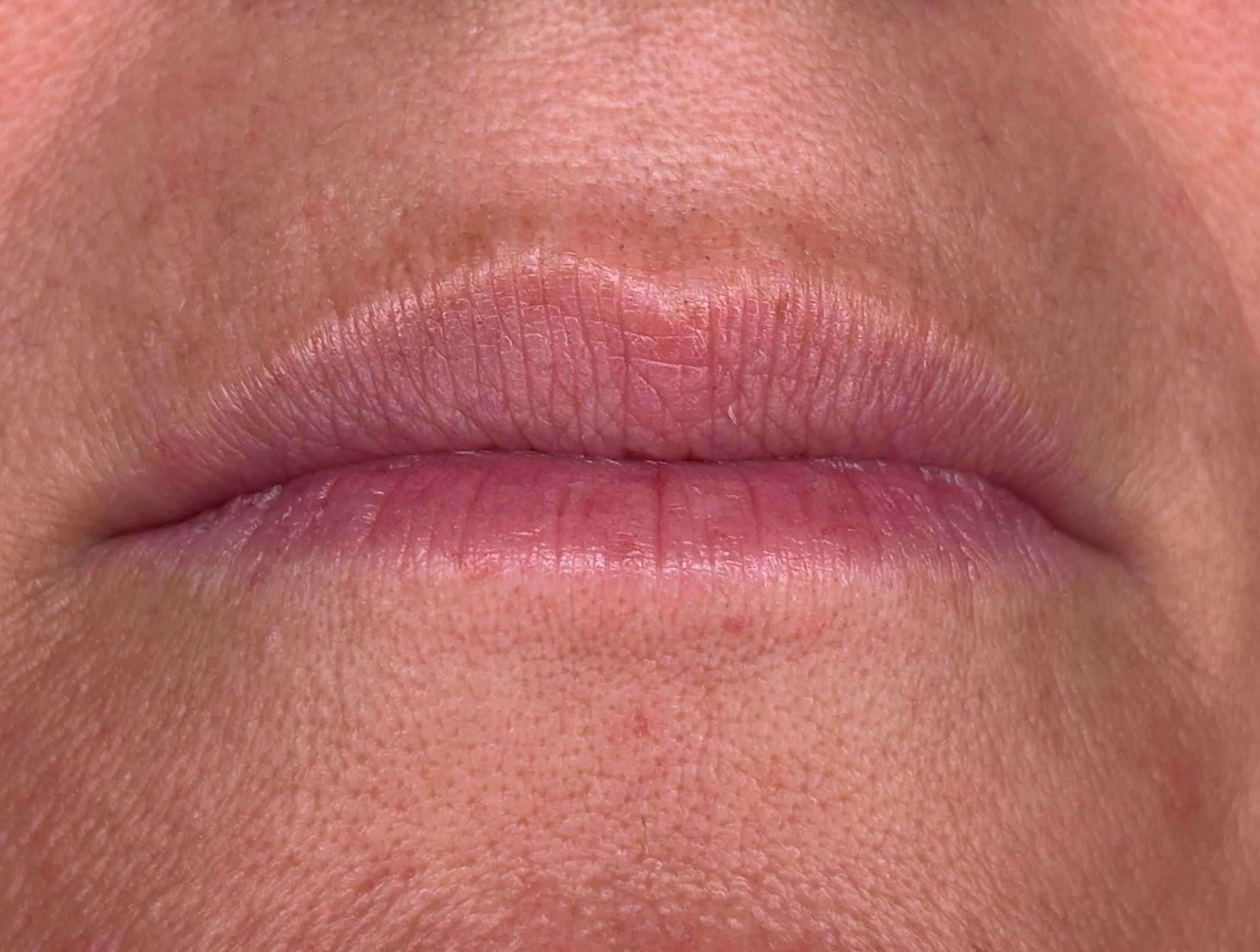 Lippen vor der Lip Blush Behandlung